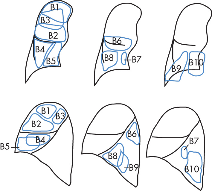 FIG. 1.2