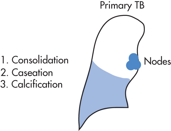 FIG. 1.16