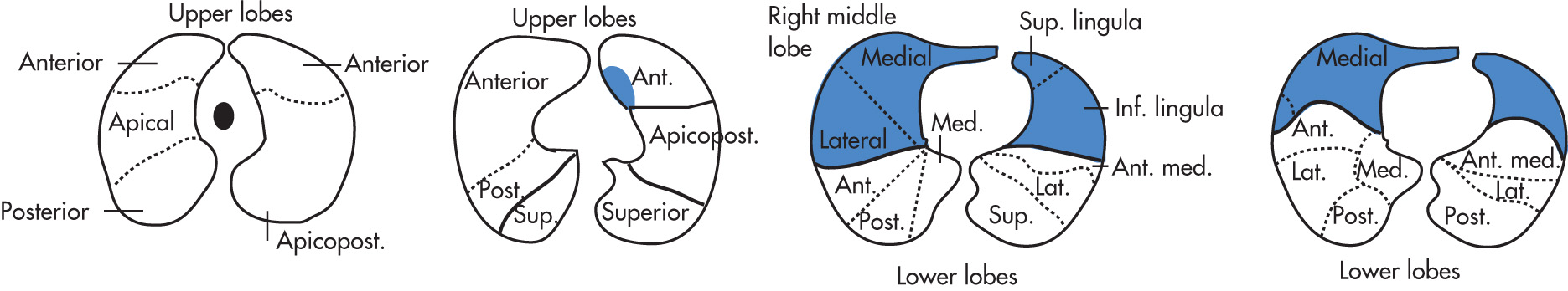 FIG. 1.3