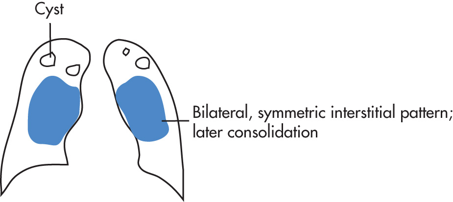 FIG. 1.29