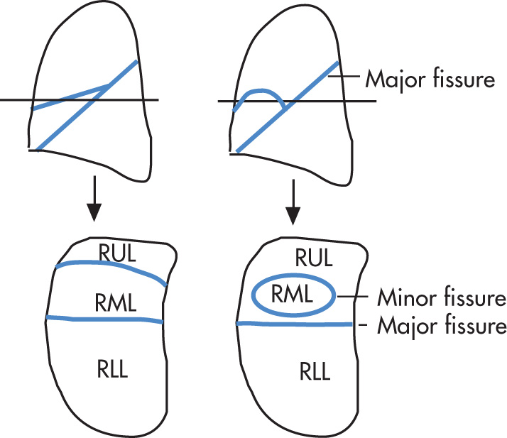 FIG. 1.8