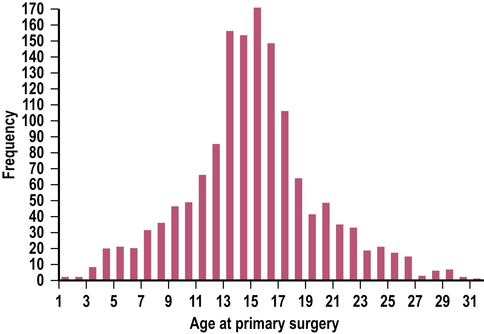 Fig. 20.6, Age distribution of the authors’ primary pectus excavatum repairs ( n = 1463; median age at surgery 15 years, range 1–31 years; data collected from 5/18/1987 to 1/1/2012).