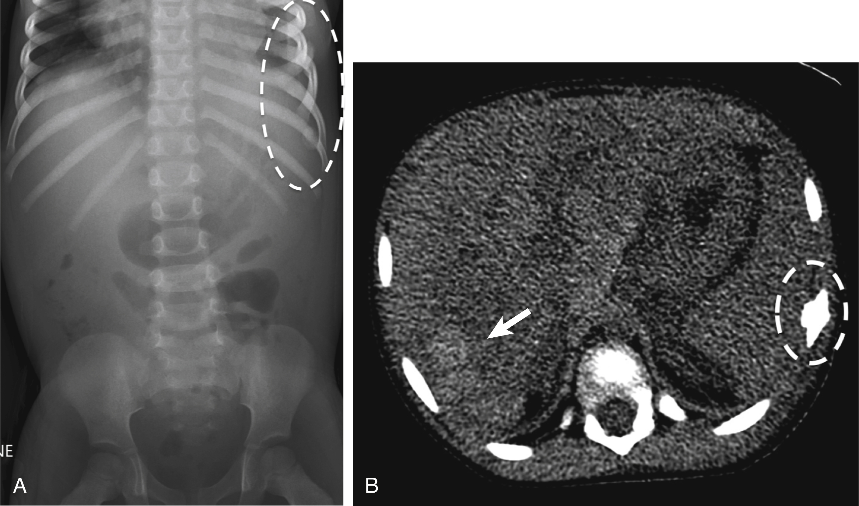 Fig. 21.4, A 4-year-old with abdominal pain.