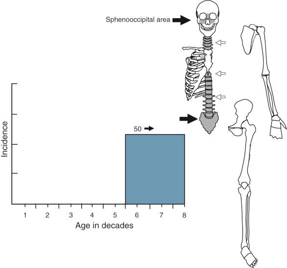 FIGURE 18-11, Chordoma.