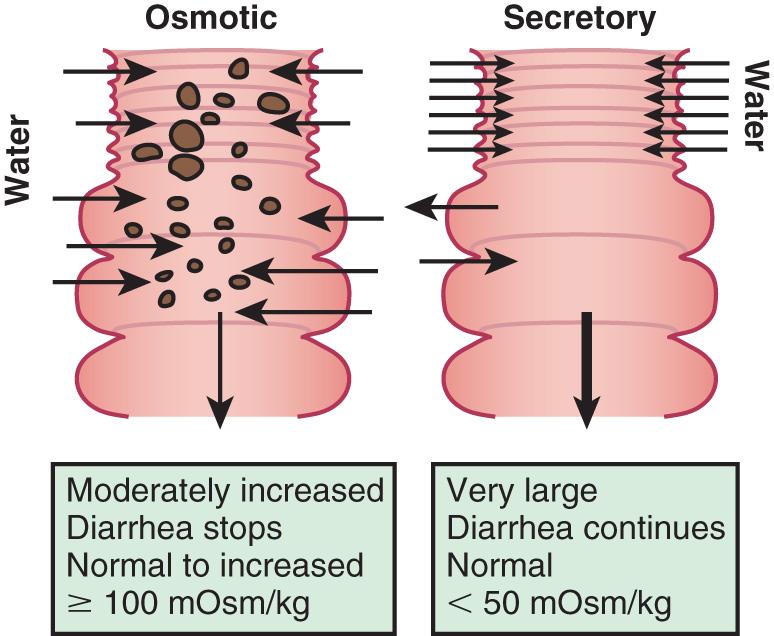 Fig. 367.1, Pathways of osmotic and secretory diarrhea.