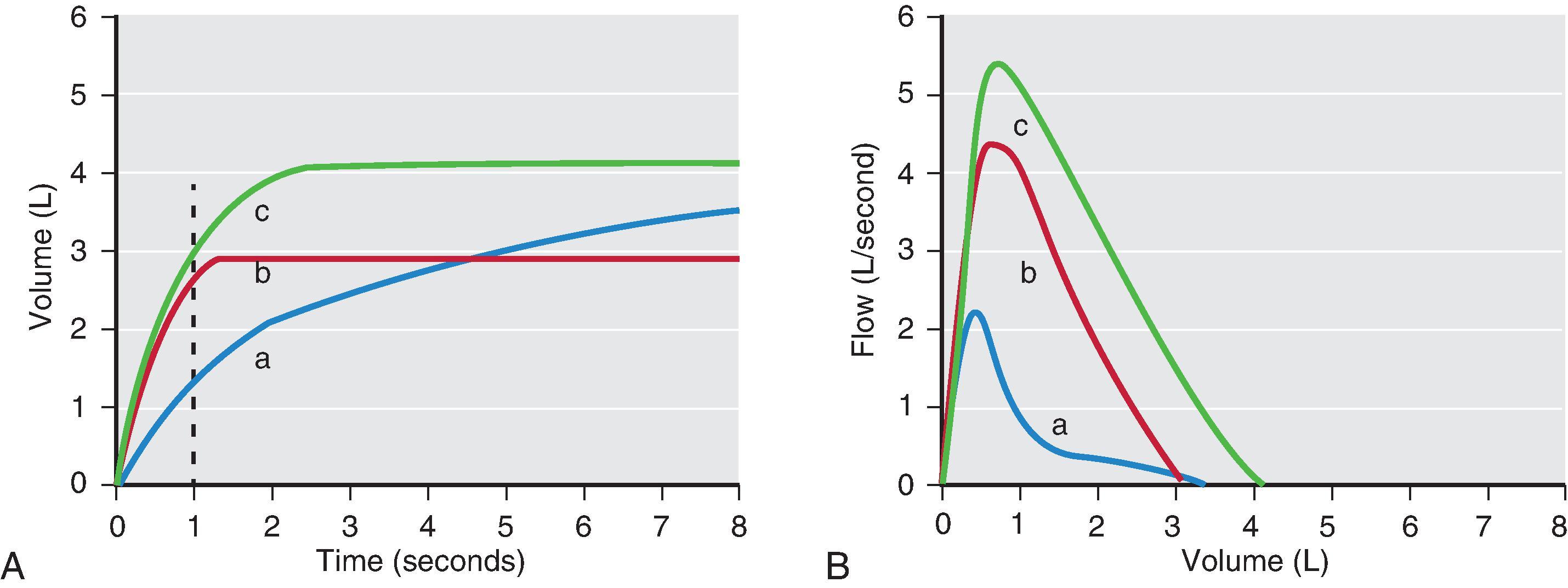 Fig. 27.1, Simple spirometry patterns in obstructive lung disease (a) , restrictive lung disease (b) , and normal patients (c) . (A) Volume–time curves. The exhaled volume during the first second of a maximal expiratory effort is the forced expiratory volume in 1 second (FEV 1 ). The maximal expired volume is the forced vital capacity (FVC). (B) Flow–volume curves. The maximal flow during a forced expiration is the peak expiratory flow (PEF). (From Patterson GA, Cooper JD, Deslauriers J, et al., eds. Pearson’s Thoracic and Esophageal Surgery. 3rd ed. Philadelphia: Elsevier; 2008, used with permission.)