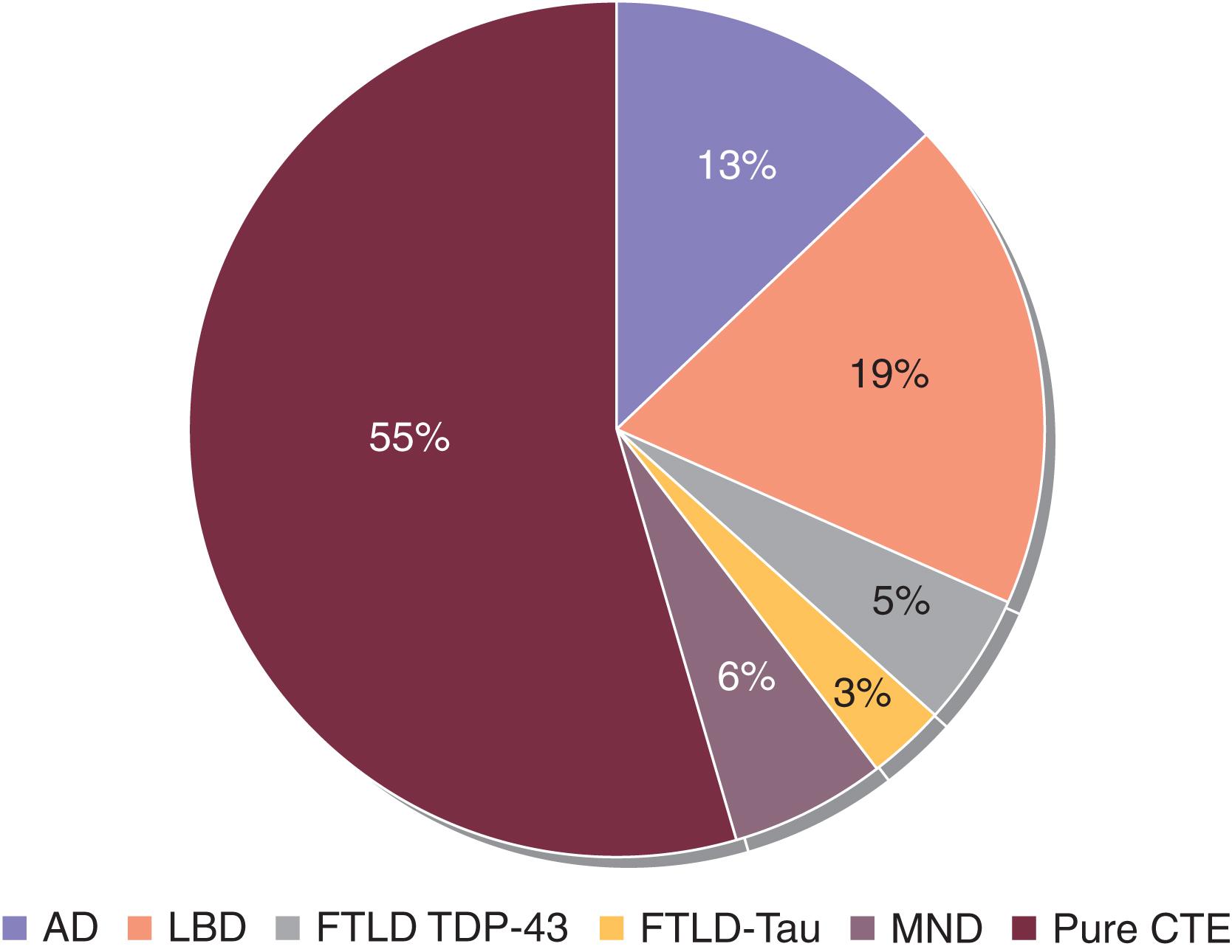 Fig. 15.2, Neuropathologic diagnoses among a cohort of 177 football players from the Veterans Affairs-Boston University-Concussion Legacy Foundation brain bank who were diagnosed with chronic traumatic encephalopathy (CTE), Alzheimer’s disease (AD) , Lewy body disease (LBD) , frontotemporal lobar degeneration from TDP-43 (FTLD TDP-43) , frontotemporal lobar degeneration from tau (FTLD-Tau) , and motor neuron disease (MND) by autopsy. Some 55% exhibited pure CTE pathology, and the remaining cases exhibited overlap with other neurodegenerative conditions, including Alzheimer’s disease, Lewy body disease, frontotemporal lobar degeneration with transactive response DNA binding protein 43, frontotemporal lobar degeneration with tau pathology (FTLD-Tau), and motor neuron disease.