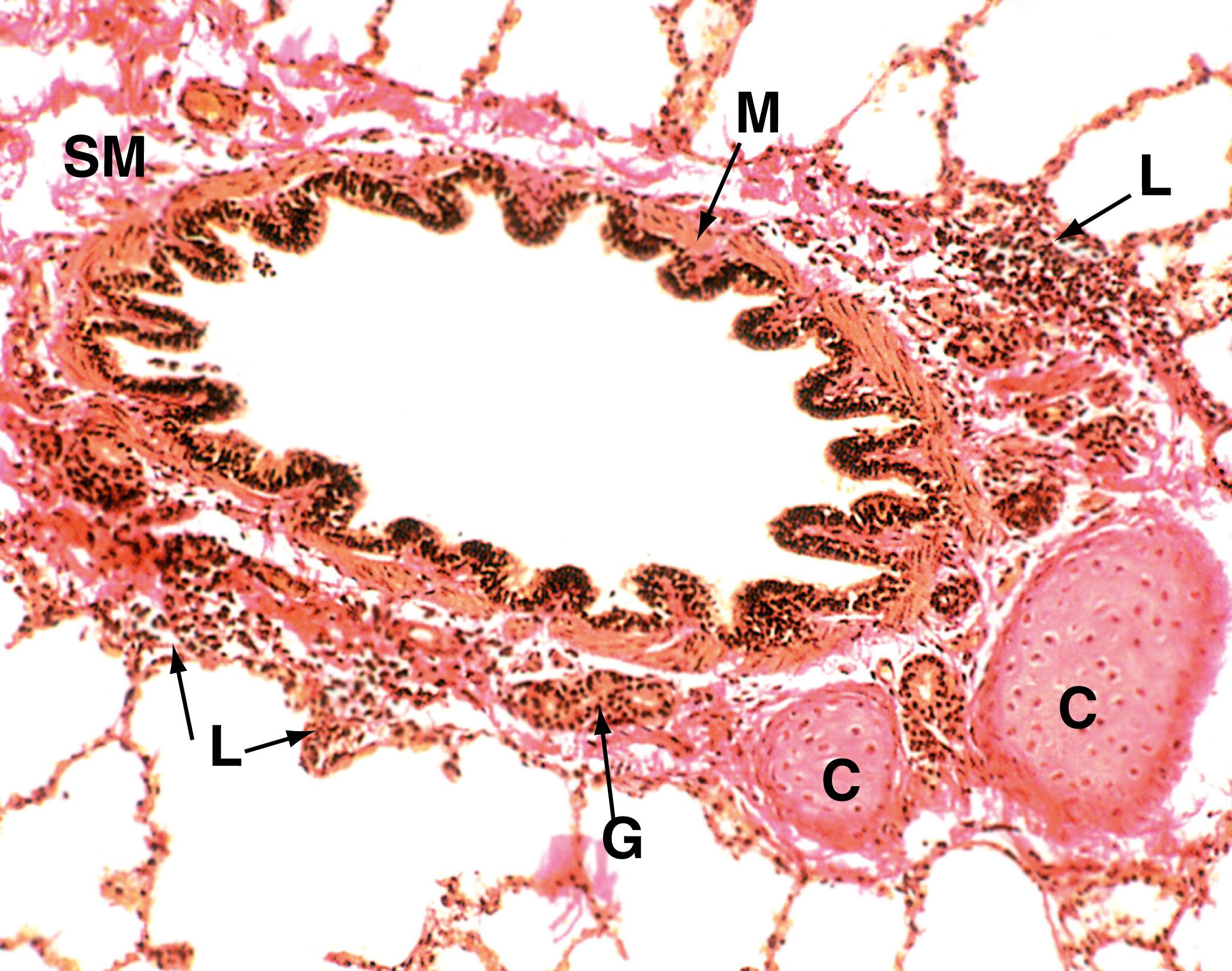 E-Fig. 4.4 H, Tertiary (segmental) bronchus Elastic van Gieson (MP). As bronchi diminish in diameter, the structure progressively changes to resemble more closely that of large bronchioles. The epithelium, just visible in this image, is tall and columnar with little pseudostratification. Goblet cell numbers are greatly diminished. The lamina propria is thin, elastic and completely encircled by smooth muscle M which is disposed in a spiral manner. This arrangement permits contraction of the bronchi in both length and diameter during expiration. Seromucinous glands G are sparse in the submucosa. These glands are rarely found within smaller airways. The cartilage framework C is reduced to a few irregular plates. Cartilage does not usually extend beyond tertiary bronchi. Note that the submucosa SM merges with the surrounding adventitia and then with the lung parenchyma. Small aggregates of lymphocytes L , part of the mucosa-associated lymphoid tissue (MALT), are seen in the adventitia.