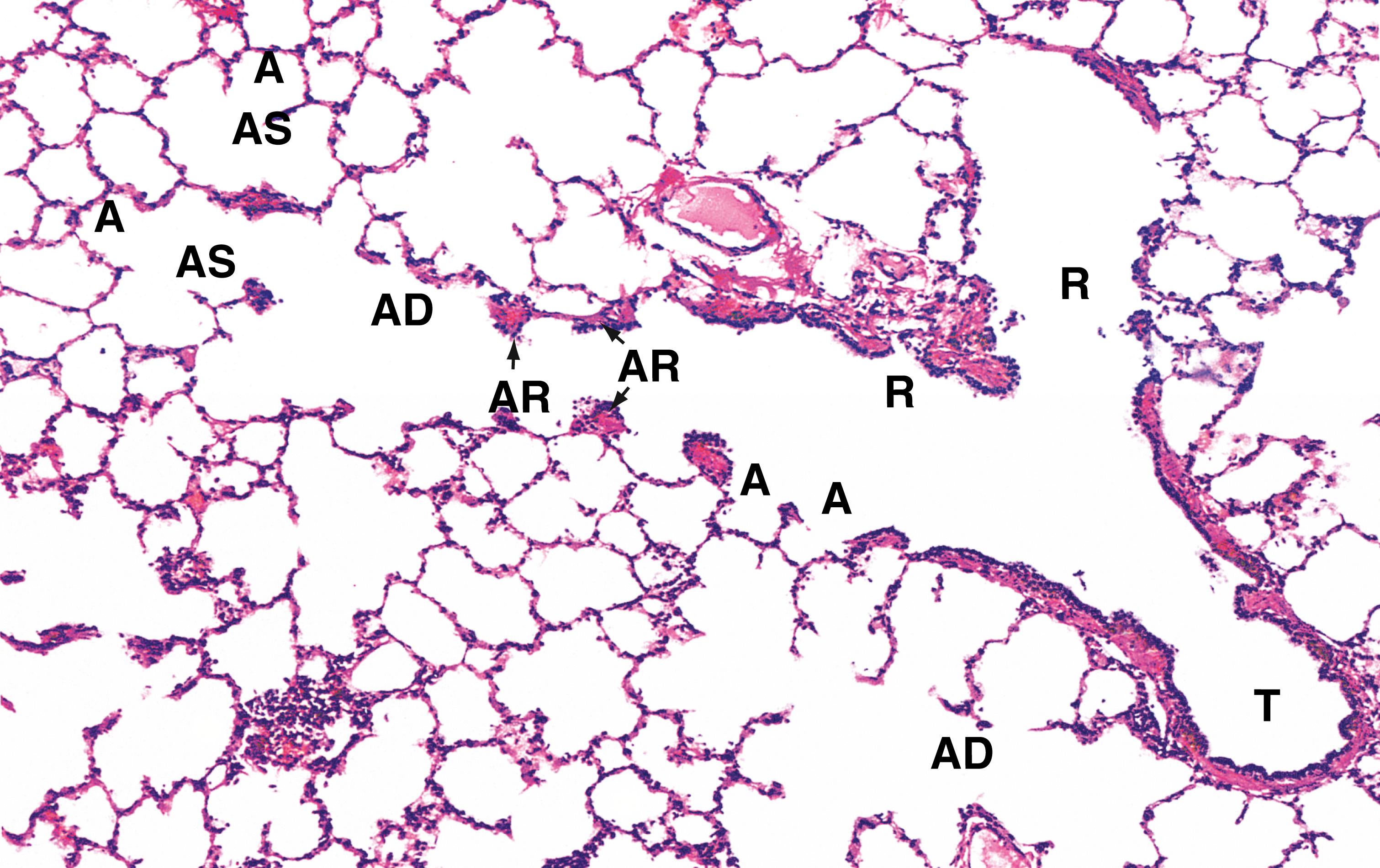 E-Fig. 4.5 H, Terminal portion of the respiratory tree H&E (LP). Terminal bronchioles T are the smallest diameter passages of the purely conducting portion of the respiratory tree. Beyond this, branches become increasingly involved in gaseous exchange. Each terminal bronchiole divides to form short, thinner walled branches called respiratory bronchioles R which contain a small number of single alveoli A in their walls. The epithelium of the respiratory bronchioles is devoid of goblet cells and largely consists of ciliated cuboidal cells and smaller numbers of non-ciliated cells called Clara cells . In the most distal part of the respiratory bronchioles. Clara cells become the predominant cell type. Clara cells have three functions: • They produce one of the components of surfactant . • They act as stem cells , i.e. they are able to divide, differentiate and replace other damaged cell types. • They contain enzyme systems which can detoxify noxious substances.