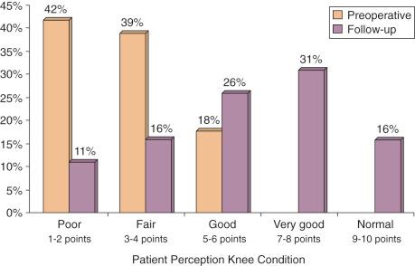 FIG 41-5, Distribution of patient perception of the overall knee condition from a clinical study on meniscus transplantation. The difference between preoperative and follow up was statistically significant ( P < .0001).