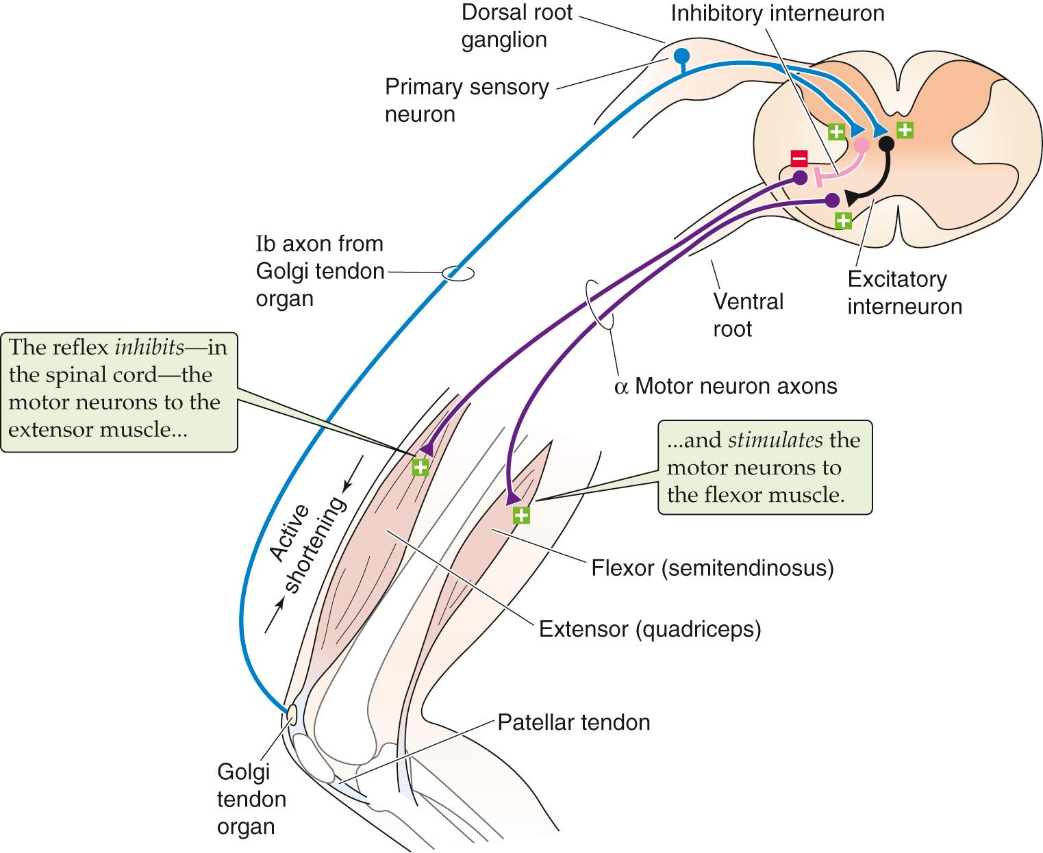 Figure 16-4, Golgi tendon organ reflex. Contraction of the quadriceps muscle can elicit a reflexive relaxation of this muscle and contraction of the antagonistic semitendinosus muscle. Contraction of the muscle pulls on the tendon; this squeezes and excites the sensory endings of the Golgi tendon organ, which convey their information via group Ib axons. These axons synapse on both inhibitory and excitatory interneurons in the spinal cord. The inhibitory interneurons innervate α motor neurons to the quadriceps, relaxing this muscle. The excitatory interneurons innervate α motor neurons to the antagonistic semitendinosus muscle, contracting it. Thus, both limbs of the reflex are polysynaptic.