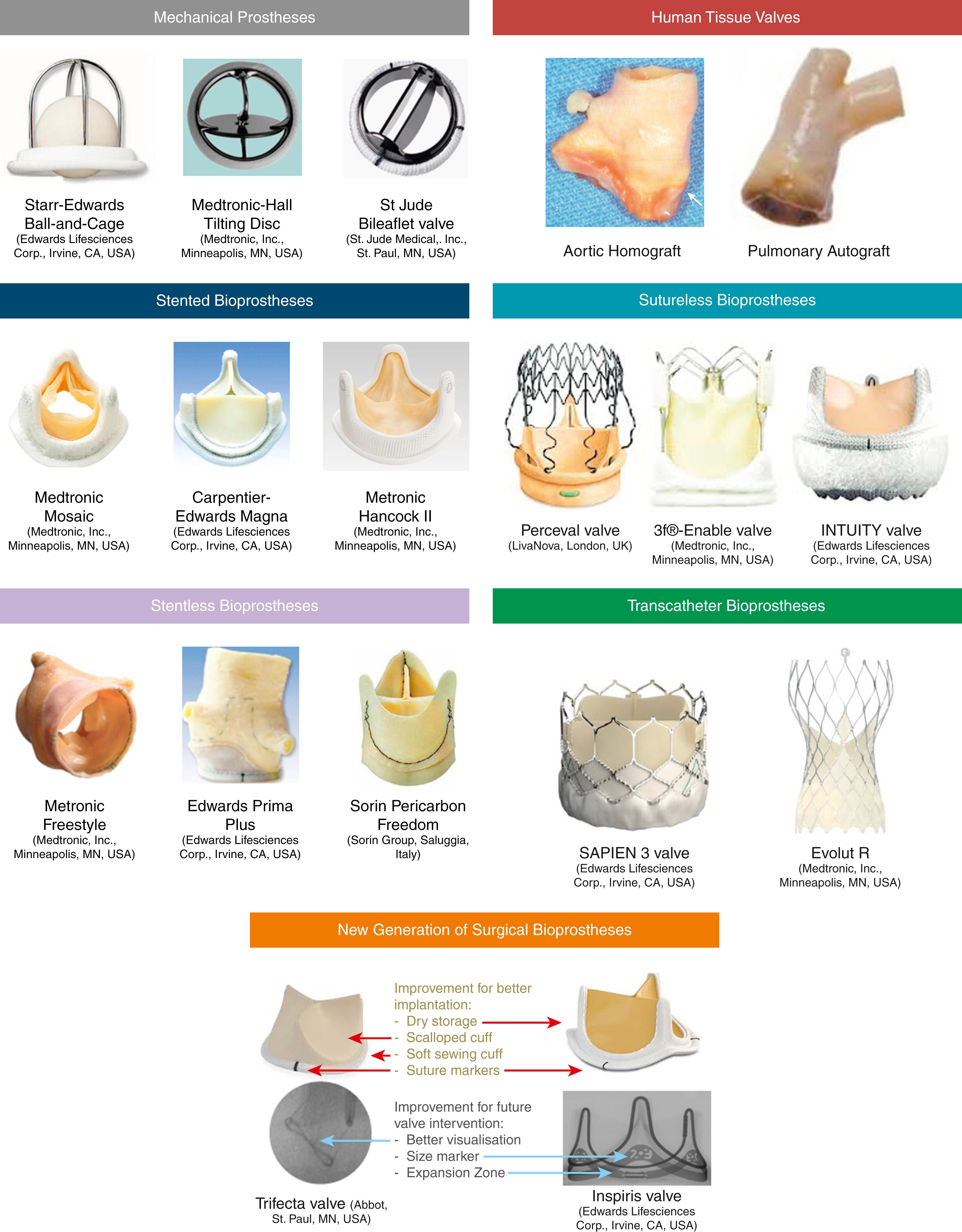 Figure 109.1, Prosthetic valve types and design.