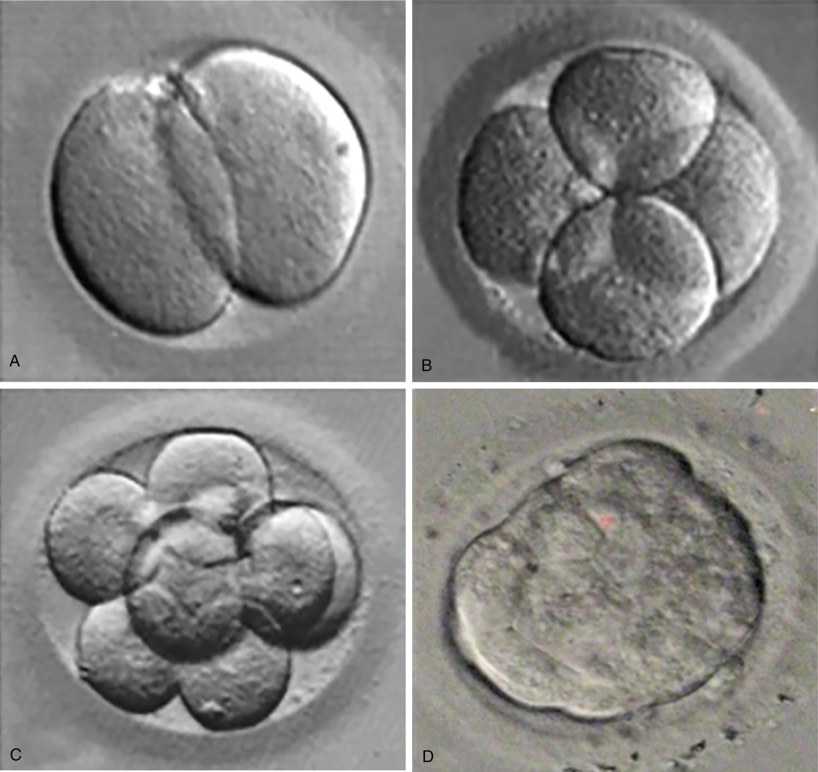 Fig. 4.2, Photomicrographs of cleavage stages of human eggs fertilized in vitro.