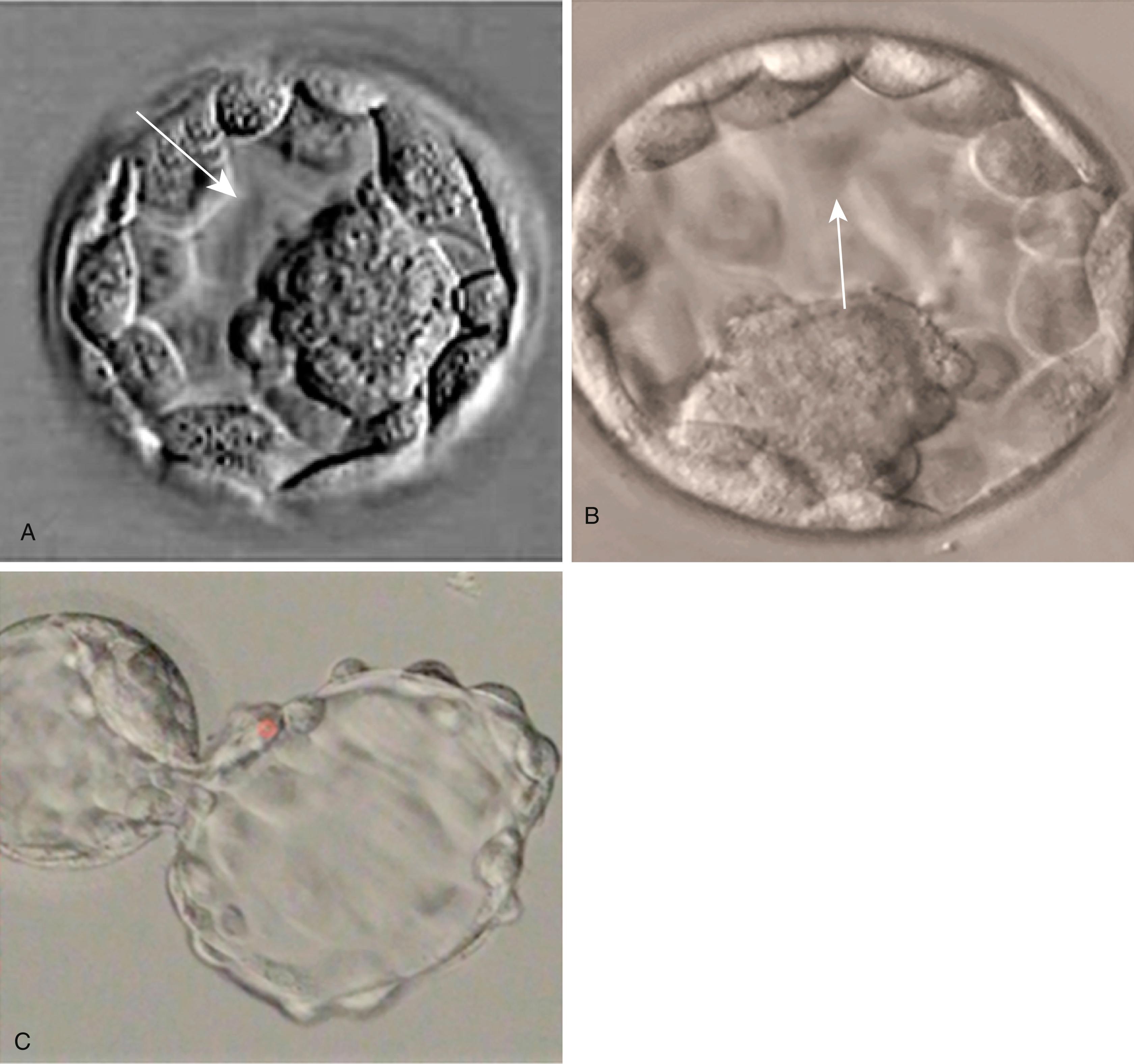 Fig. 4.3, Human embryos resulting from in vitro fertilization.