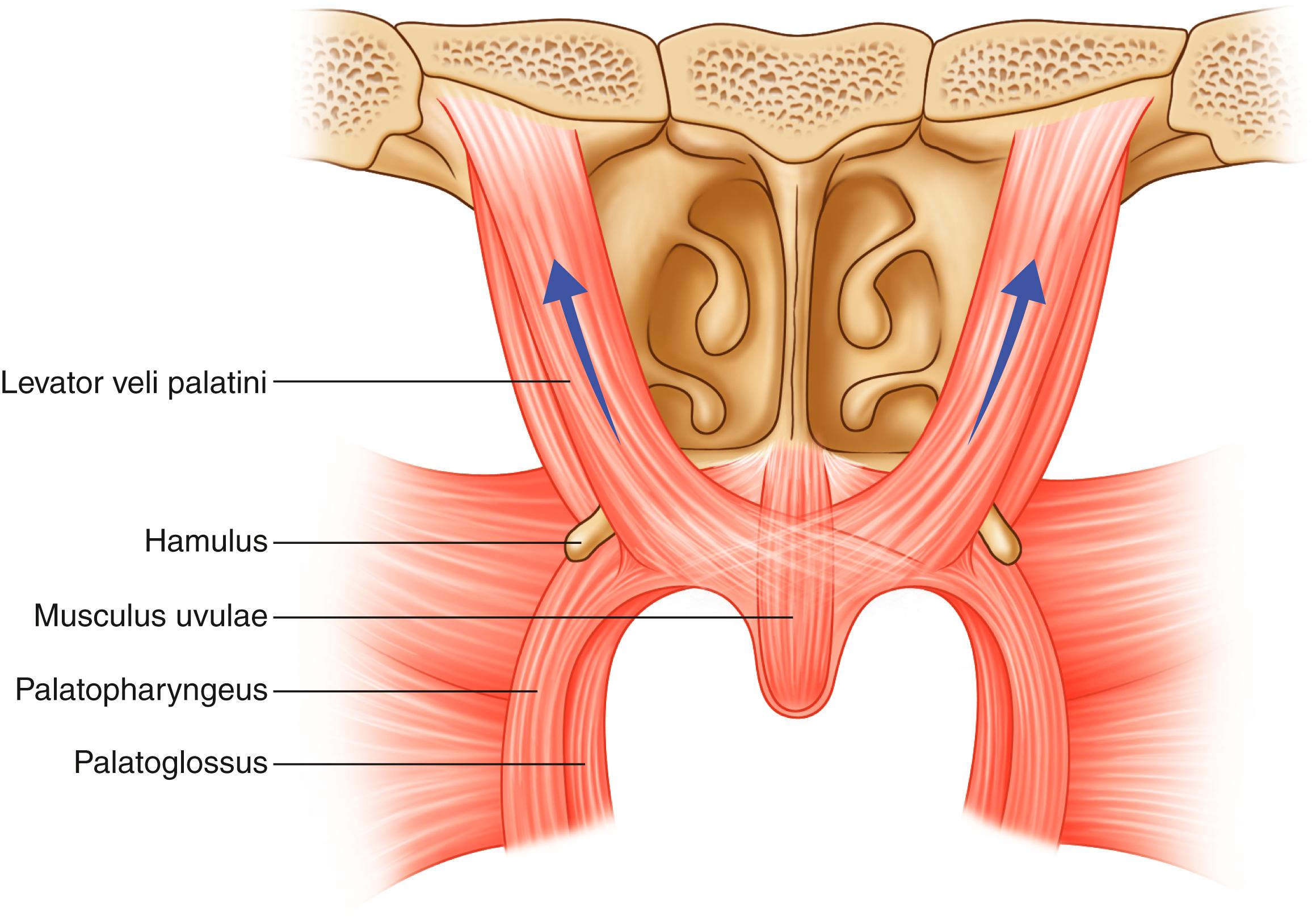 Fig. 17.2, A nasal view of dissected soft palate musculature, demonstrating the position of the levator veli palatini, which occupies the intermediate 40% of the soft palatal length.