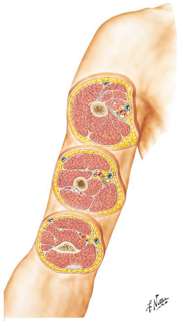 Figure 12.1, Cross-sectional anatomy of the arm.