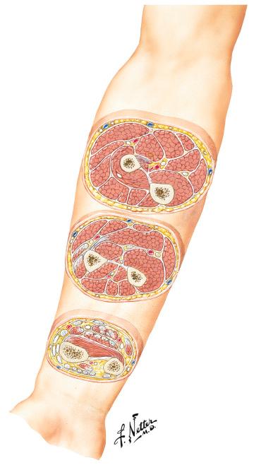 Figure 12.8, Cross-sectional anatomy of the forearm.