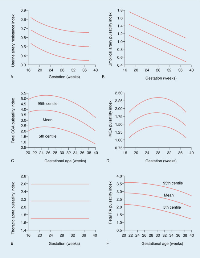 FIGURE 15-7, Normal values during pregnancy for (A) uterine artery resistance index (RI), and (B) umbilical artery pulsatility index (PI). Fetal common carotid artery (CCA) PI (C) falls steeply after 32 weeks gestation, mirrored by the middle cerebral artery (MCA) PI (D). Normal values are also shown for the fetal descending thoracic aorta PI (E) and renal artery (RA) PI (F).