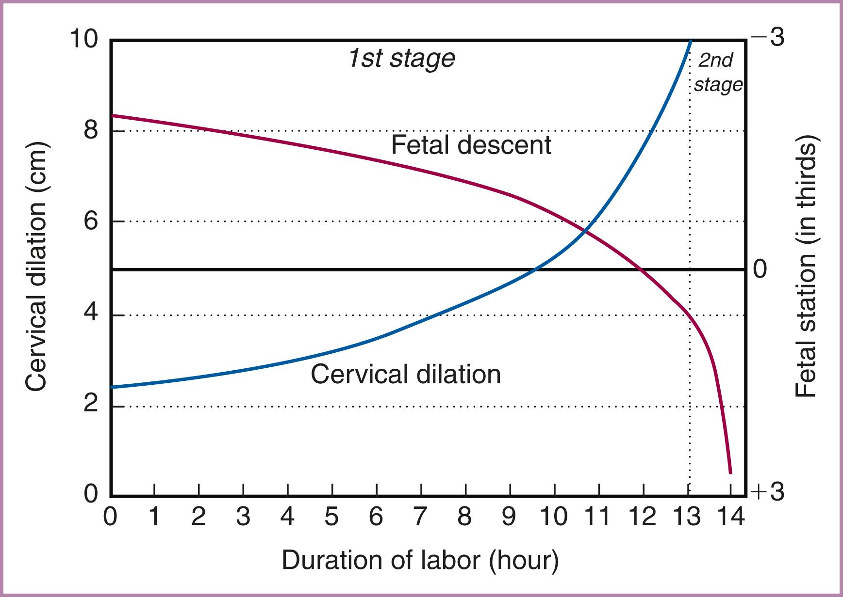 Figure 40.5, Patterns of cervical dilation and fetal descent in nulliparas.