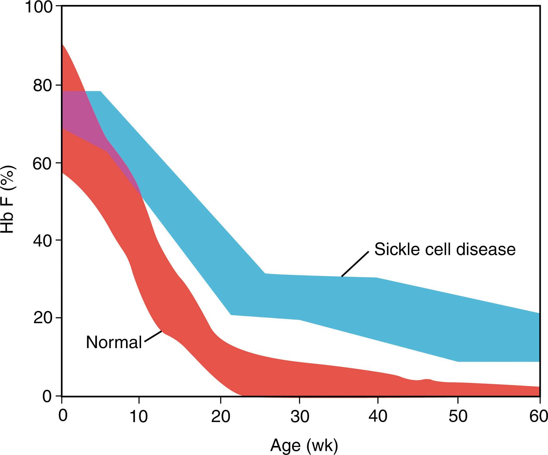 Figure 43.3, FETAL HEMOGLOBIN DECLINE IN CHILDREN WITH HEMOGLOBINS AA AND SS.