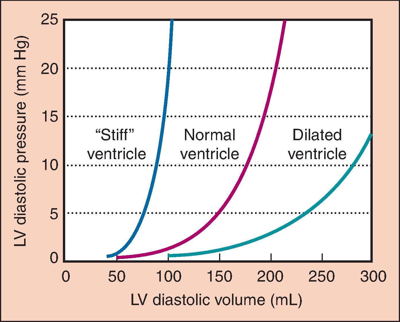 Fig. 5.1, The pressure–volume relationship of the heart in diastole is shown in the compliance curves plotting left ventricular (LV) diastolic volume versus pressure. The “stiff” heart shows a steeper rise of pressure with increased volume than the normal heart. The dilated ventricle shows a much more compliant curve.