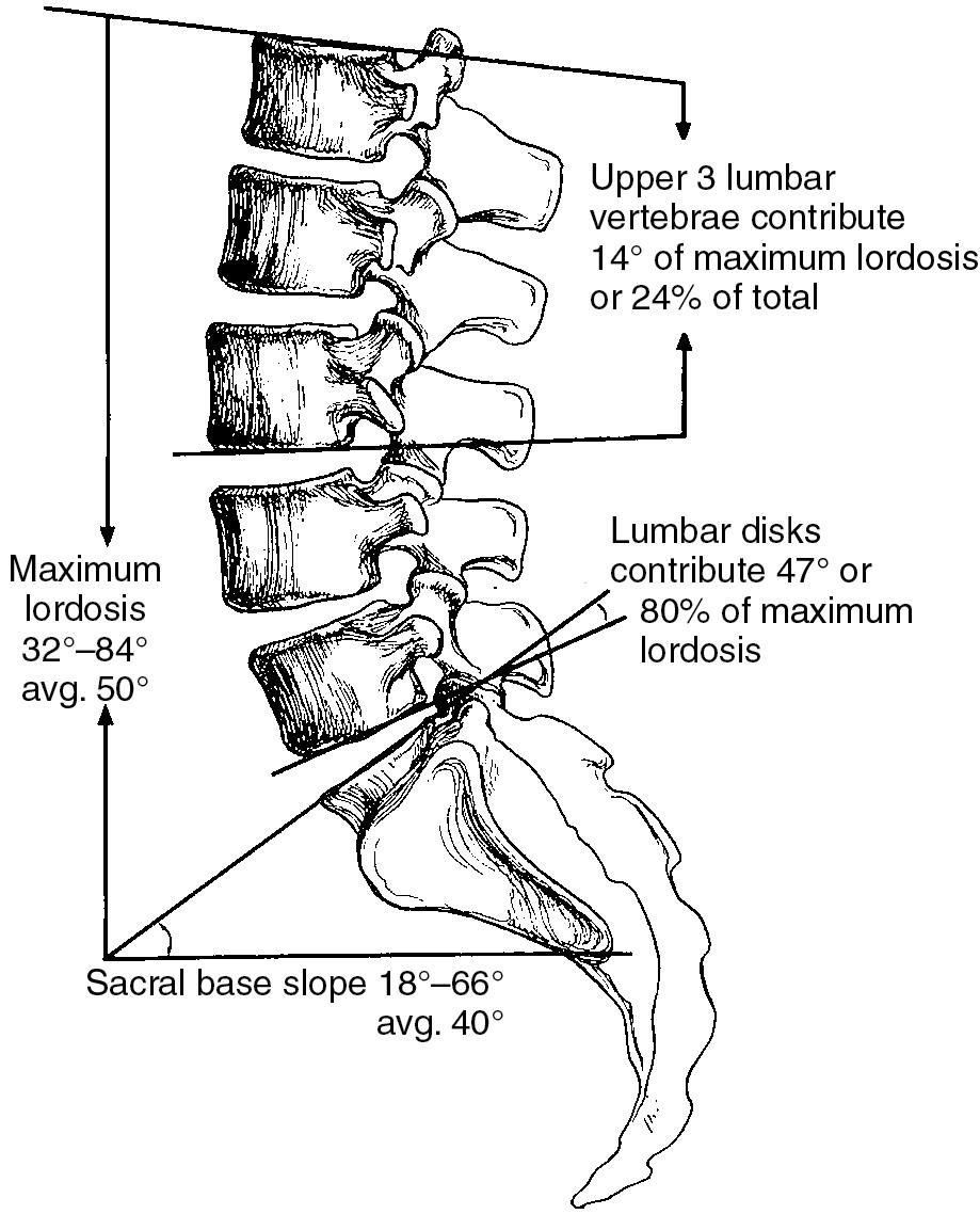 Fig. 3.3, Sagittal alignment of the lumbar spine. Average maximum lordosis as measured from superior L1 to superior S1.