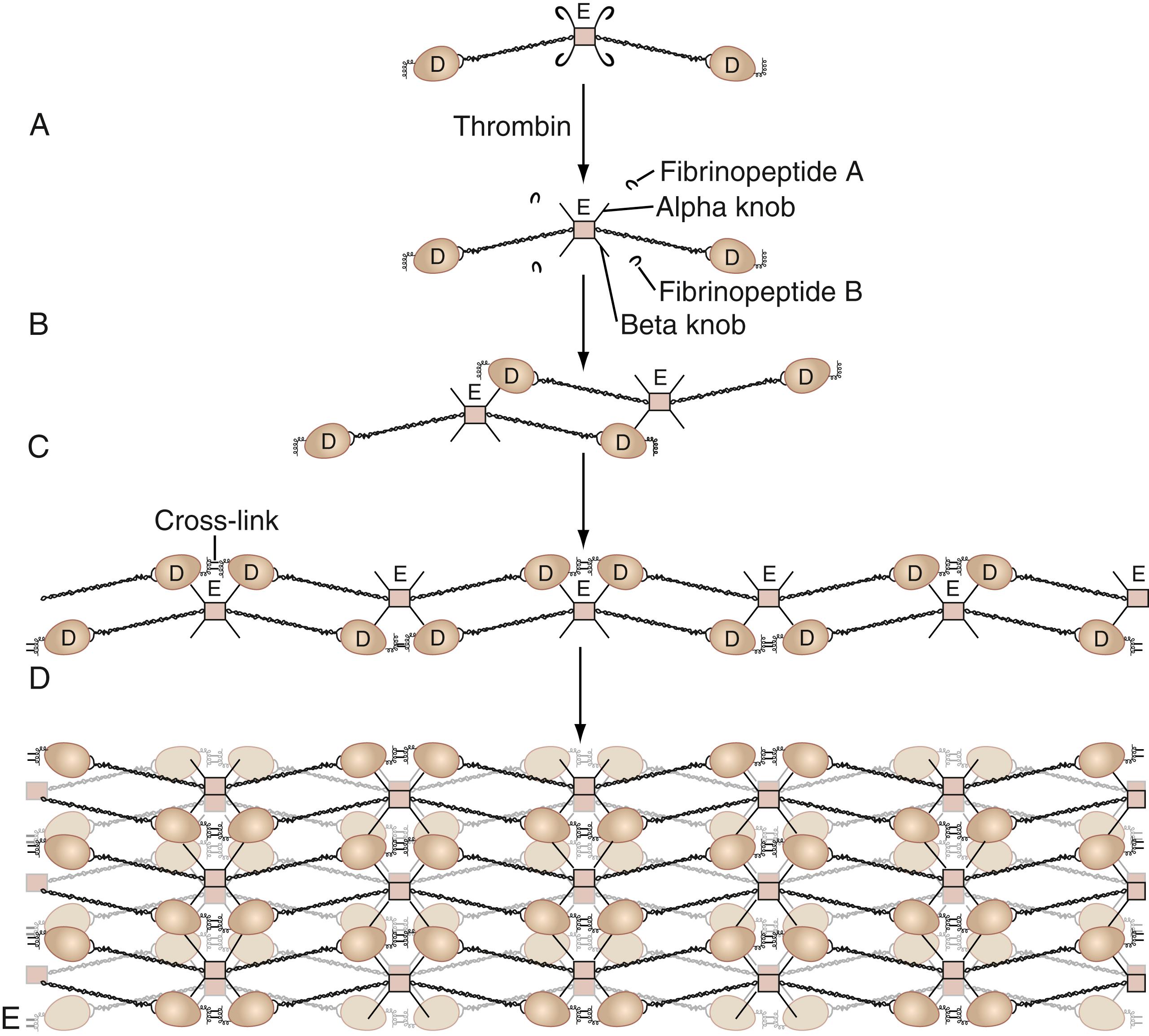 Figure 40.2, Formation of a fibrin clot. A, Schematic of fibrinogen. B, Thrombin proteolyzes fibrinopeptides A and B from fibrinogen to leave soluble fibrin monomer. Soluble fibrin monomer then associates side to side (C) and end to end (not shown, for clarity) to form fibrin polymers. D, Thrombin-activated factor XIII (factor XIIIa) covalently cross-links the fibrin polymers into an increasingly complex structure and an ultimately insoluble clot (E) . Note that “E” corresponds to the central domain of the original fibrinogen molecule and “D” to the peripheral domains