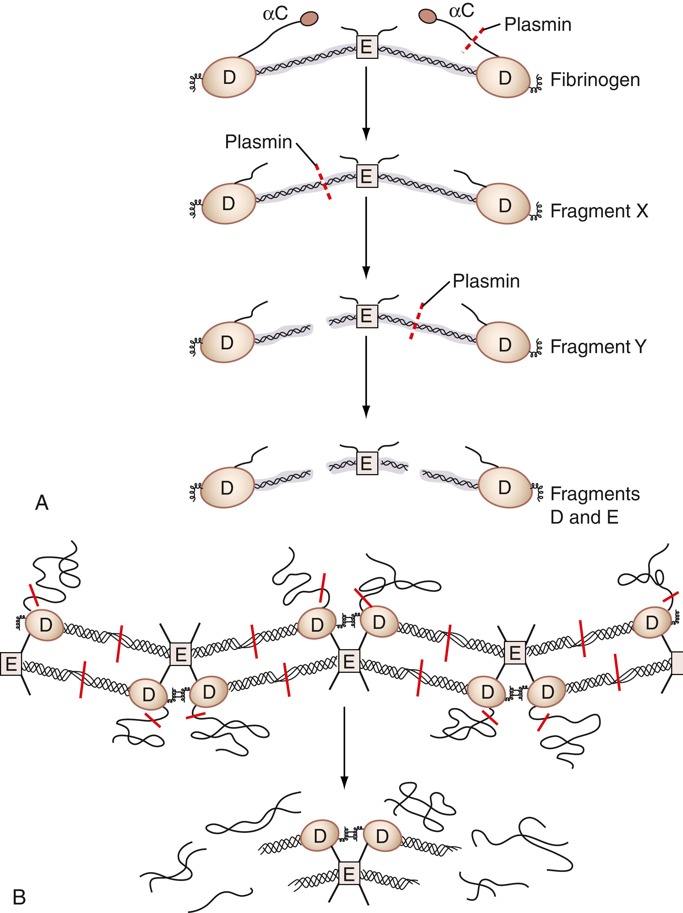 Figure 40.4, A, Plasmin-cleaved soluble fibrinogen or fibrin. When plasmin cleaves fibrinogen, initially small portions from the α-chain (αC) are removed to make Fragment X. Fragment X is then asymmetrically cleaved into Fragment D and Fragment Y. Fragment Y is further cleaved by plasmin into Fragments D and E. (Modified with permission from Greenberg CS, Lai T-S: Fibrin formation and stabilization. In Loscalzo J, Schafer AI, editors: Thrombosis and hemorrhage, ed 3, Philadelphia, 2003, Lippincott Williams & Wilkins, p 83, Fig. 5.3 B.) B, Plasmin-cleaved insoluble, cross-linked fibrin. When insoluble, cross-linked fibrin is proteolyzed by plasmin, the neo-epitope between the D-domains is preserved, and the liberated fragment consists of the D-dimer together with an E domain.