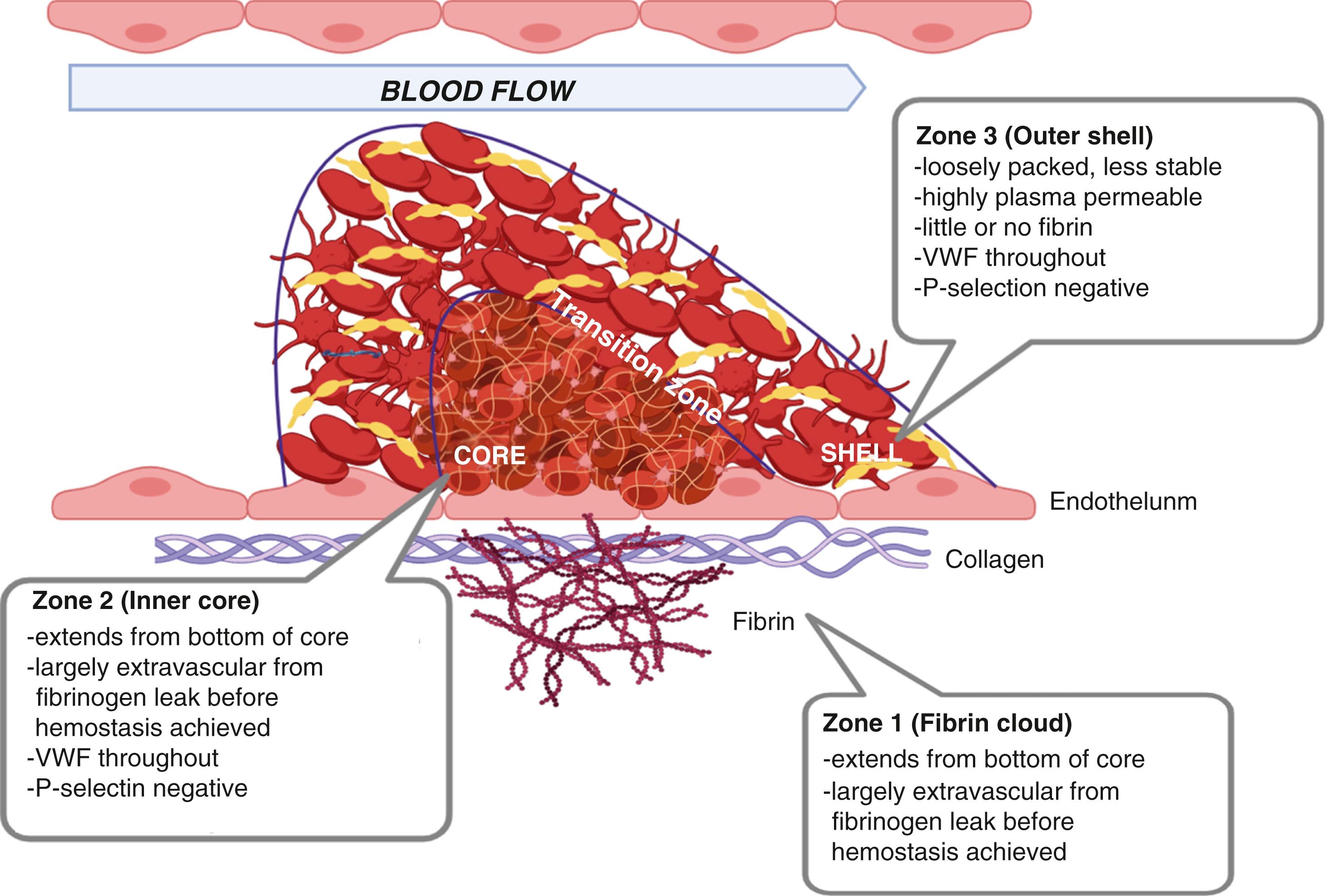 Figure 18.3, Thrombus architecture.