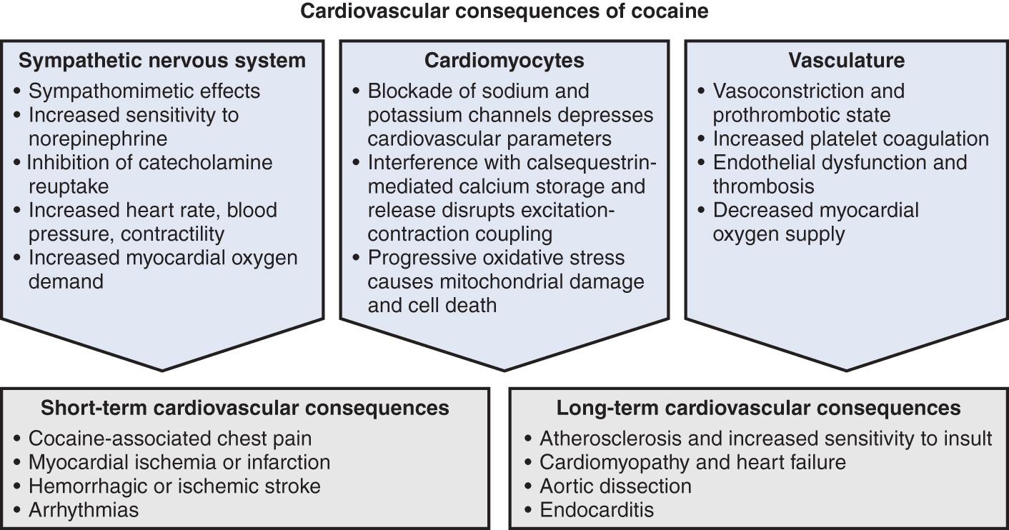 Fig. 49.2, Cardiovascular consequences of cocaine schematic diagram depicting the physiological effects of cocaine on the sympathetic nervous system, cardiomyocytes, and vasculature and subsequent short- and long-term clinical cardiovascular consequences.
