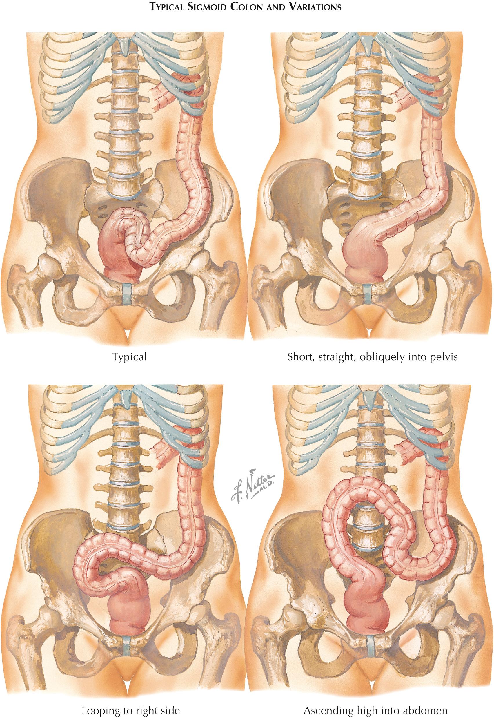 Plate 3-6