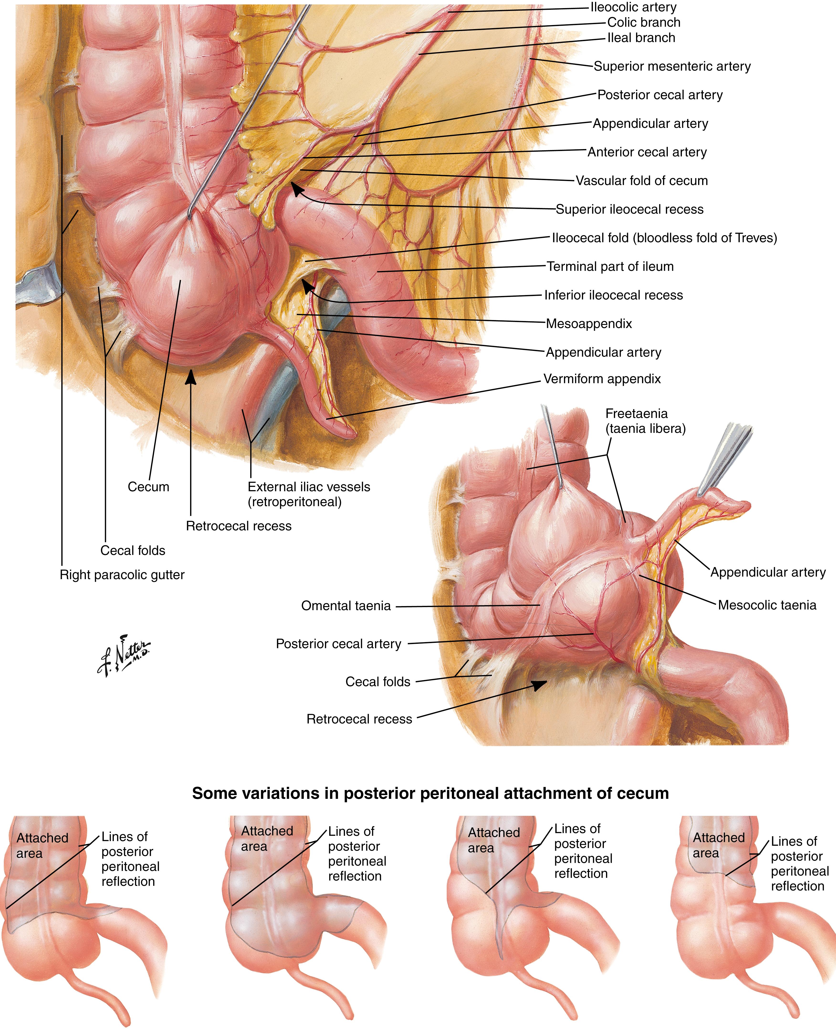 Fig. 52.5, The appendix and mesoappendix in relation to the cecum and surrounding structures.