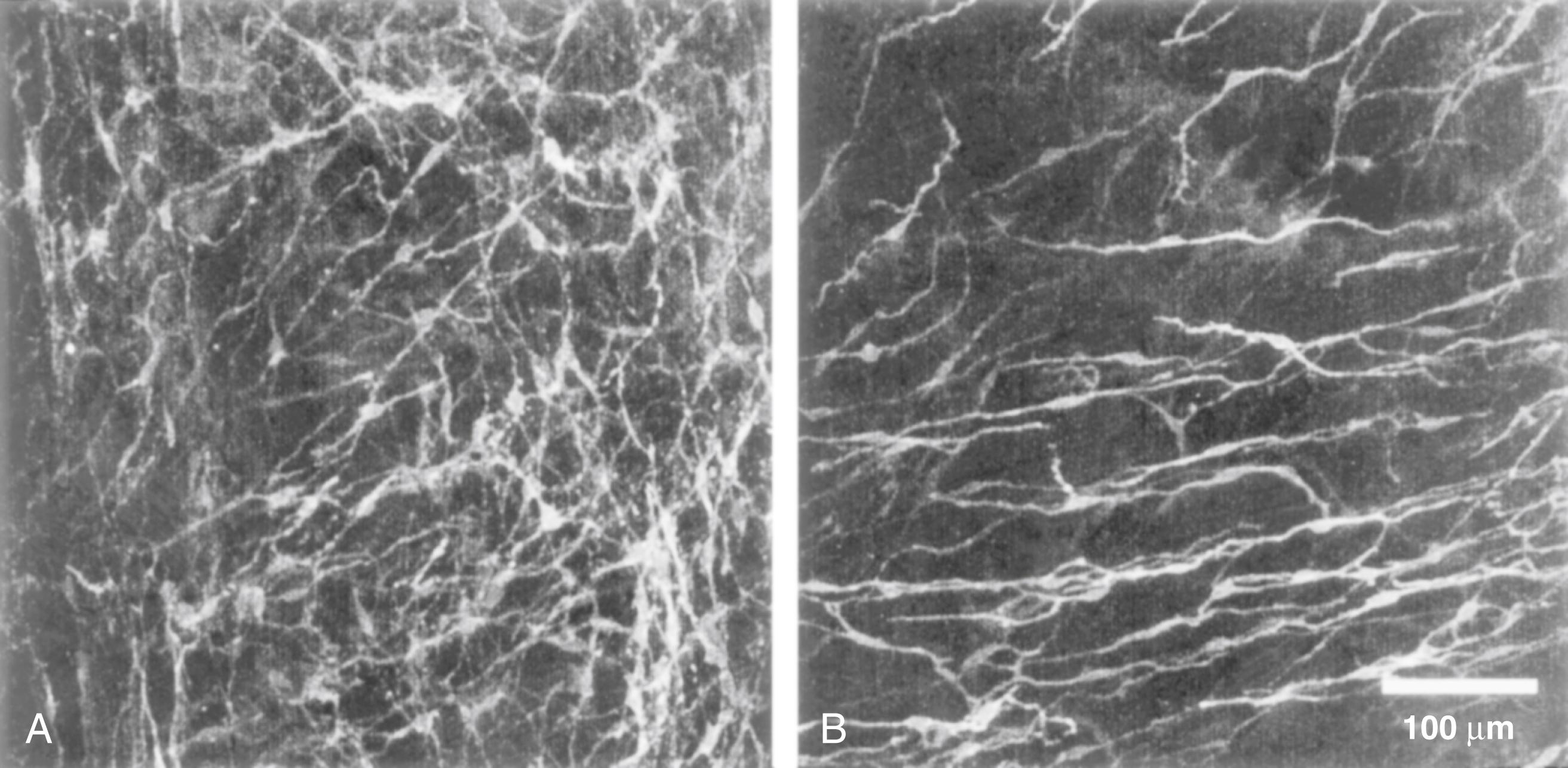 Fig. 100.2, Micrographs of interstitial cells of Cajal (ICC) in the human colon, labeled by c-Kit immunohistochemistry. A, ICC in the plane of the myenteric plexus (ICC MY ) have an irregular shape, form a dense network of cells, and probably function as pacemakers. B, A different plane of focus of the same region shows spindle-shaped intramuscular ICC (ICC IM ) in the overlying circular muscle layer. These cells probably are involved in neuromuscular transmission to smooth muscle.