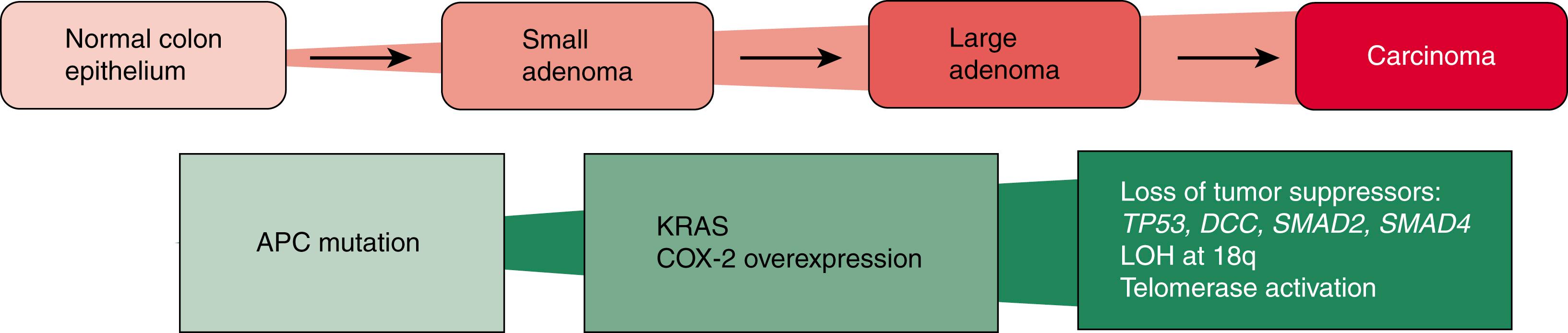 Fig. 126.3, The adenoma-carcinoma sequence in the “chromosomal instability” pathway. The progression from adenoma to carcinoma results from an accumulation of molecular genetic alterations involving activation of oncogenes ( KRAS ) inactivation of tumor suppressor genes ( APC, TP53, DCC, SMAD2, SMAD4 ). The adenoma progression phase is accelerated in patients with Lynch syndrome (hereditary non-polyposis colorectal cancer syndrome), accounting for the often rapid progression of adenomas to carcinoma through the “microsatellite instability” pathway. (See text for details.) LOH, loss of heterozygosity.