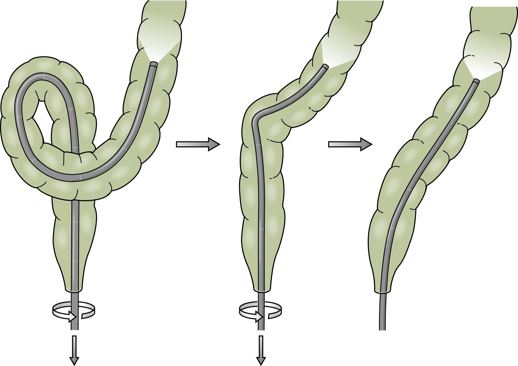 Fig. 61.9, α Loop.