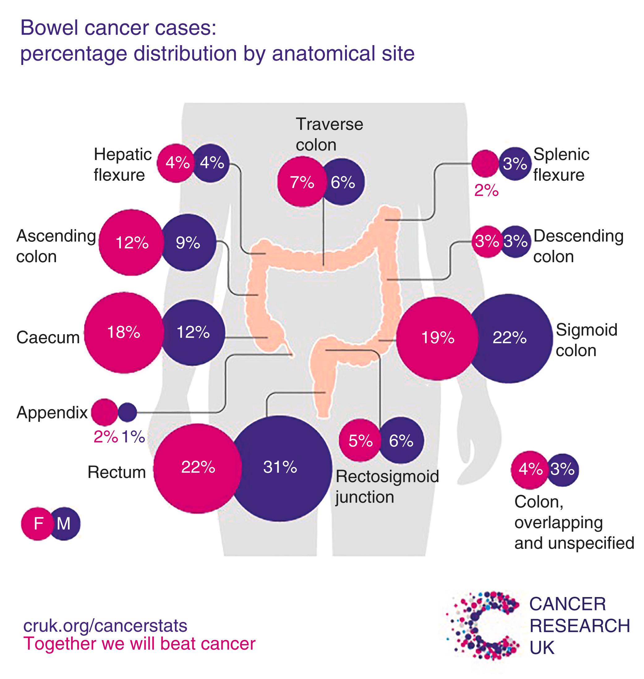 Figure 2.1, Frequency of anatomical locations of colorectal cancer for men and women in the UK (2010–2012).