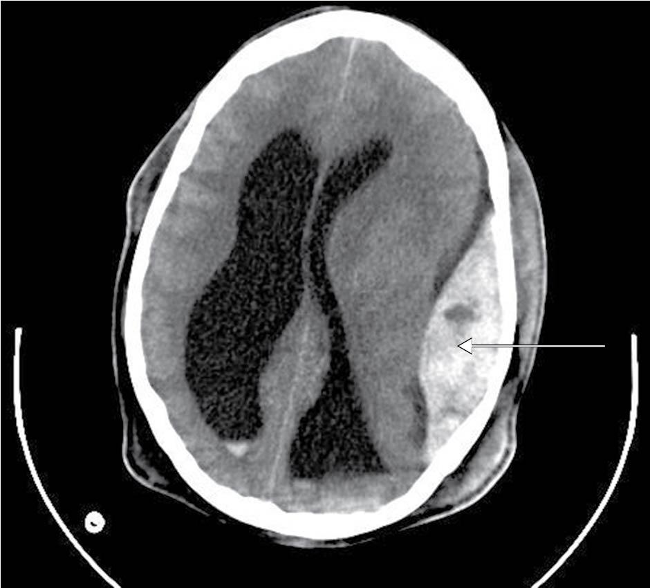 Figure 11, CT of the head .