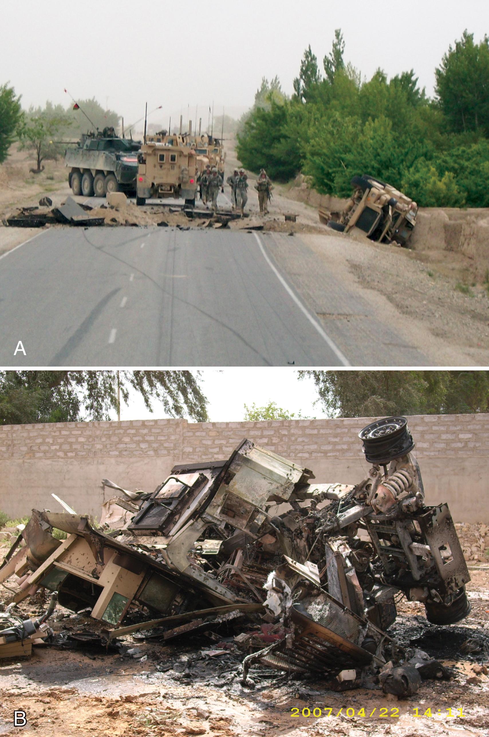 FIGURE 2, (A) Blast crater and overturned vehicle from an improvised explosive device (IED) placed on a main roadway. (B) Military vehicle destroyed by an IED.