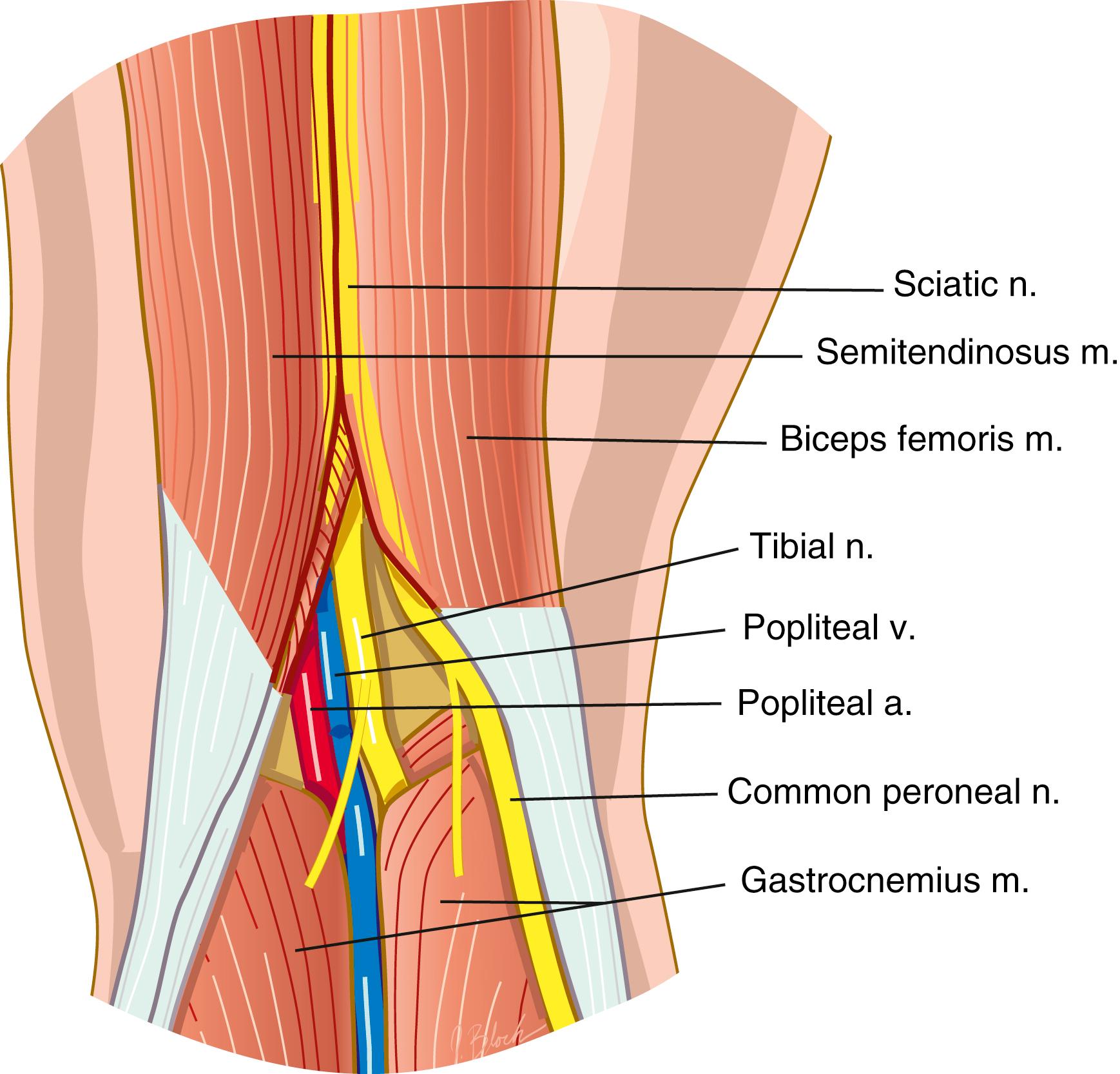 FIG. 172.2, Anatomy of the common peroneal nerve at the popliteal fossa. a., Artery; m., muscle; n., nerve; v., vein.