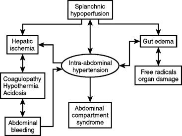 F igure 61-2-1, A cycle of ischemia producing intra-abdominal hypertension and the abdominal compartment syndrome.