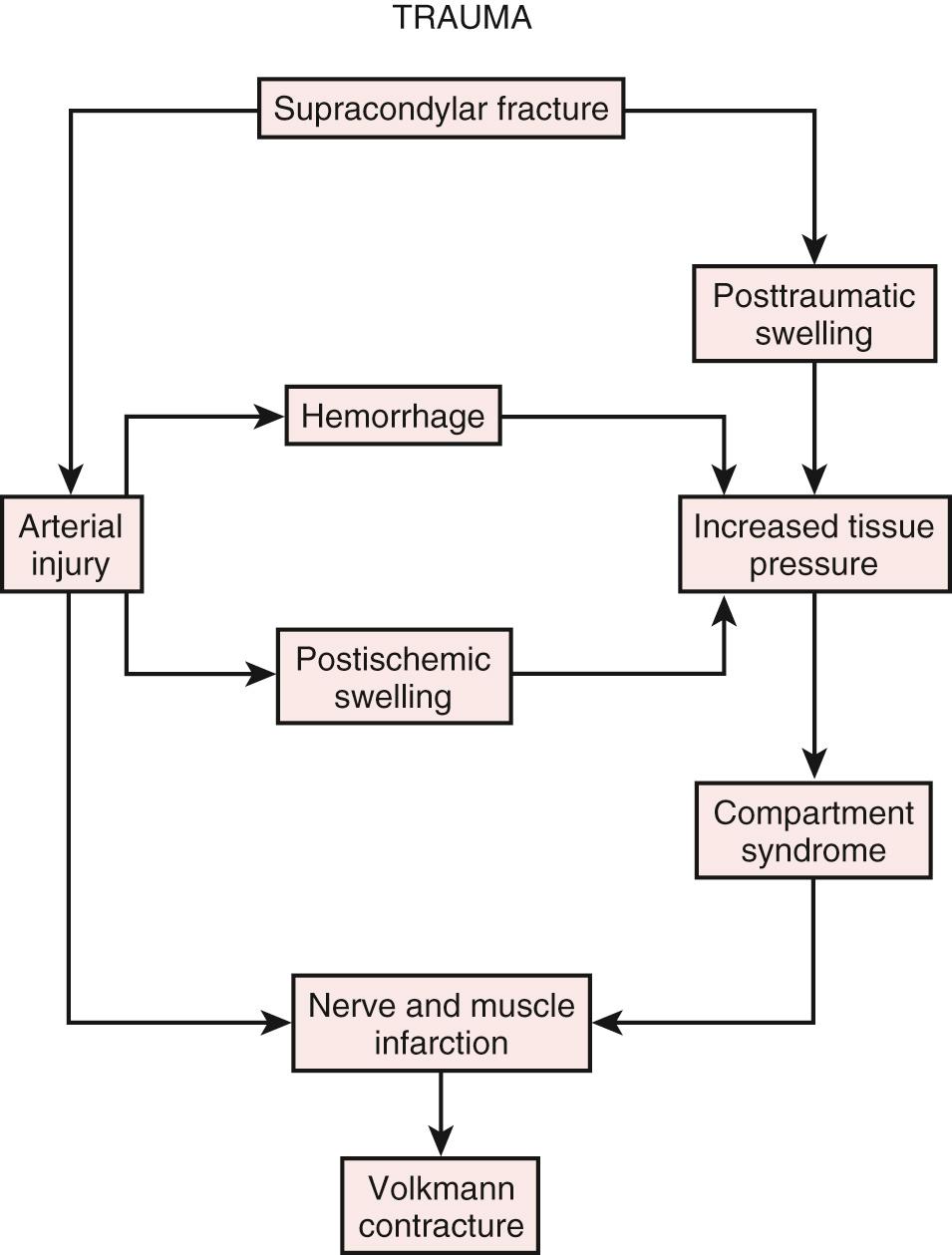 FIG 28.3, Diagrammatic representation of the possible mechanisms of Volkmann contracture.