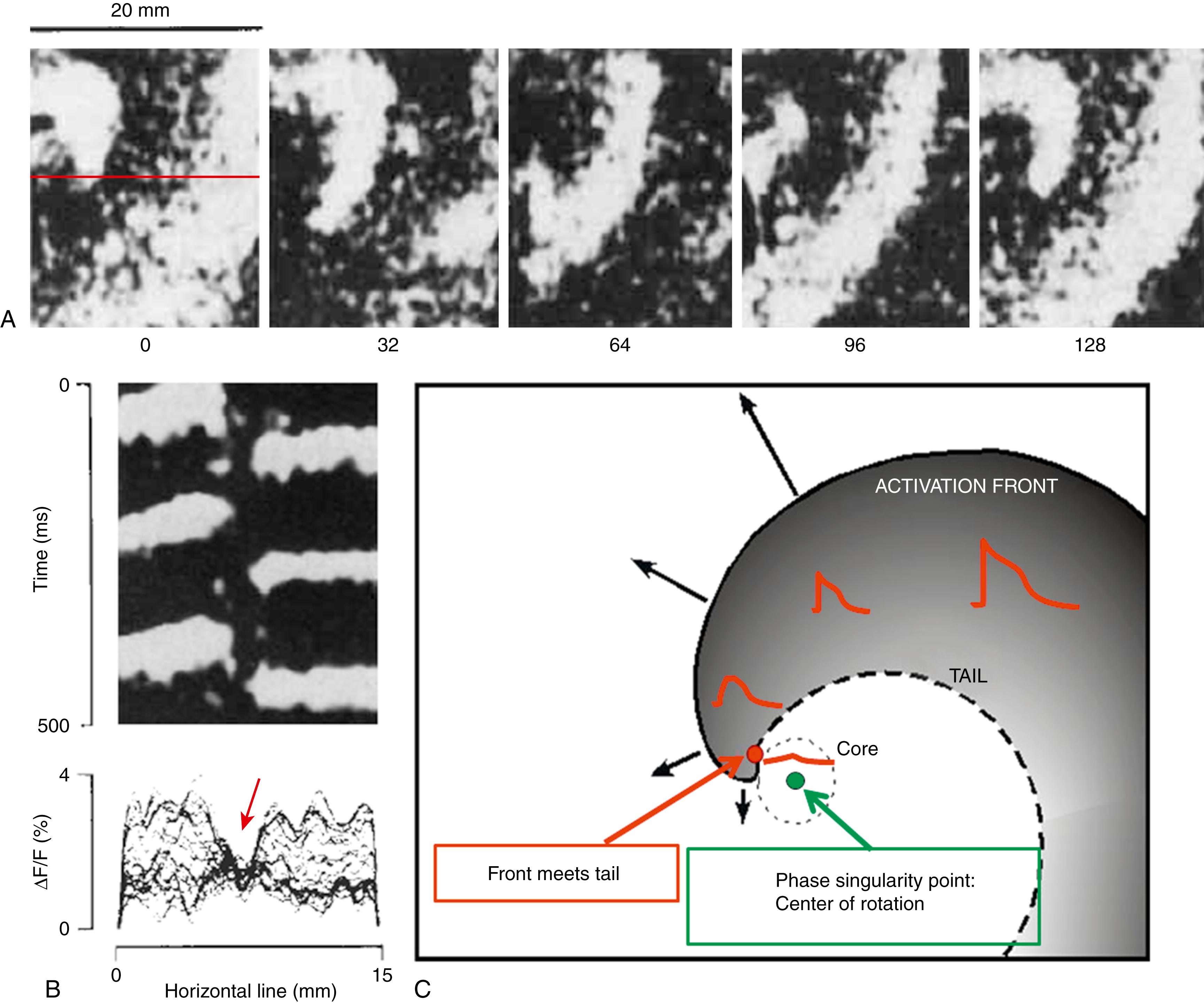 Fig. 35.1, Rotor in Optical Mapping (the Gold Standard) and Low Amplitude at the Core Region.