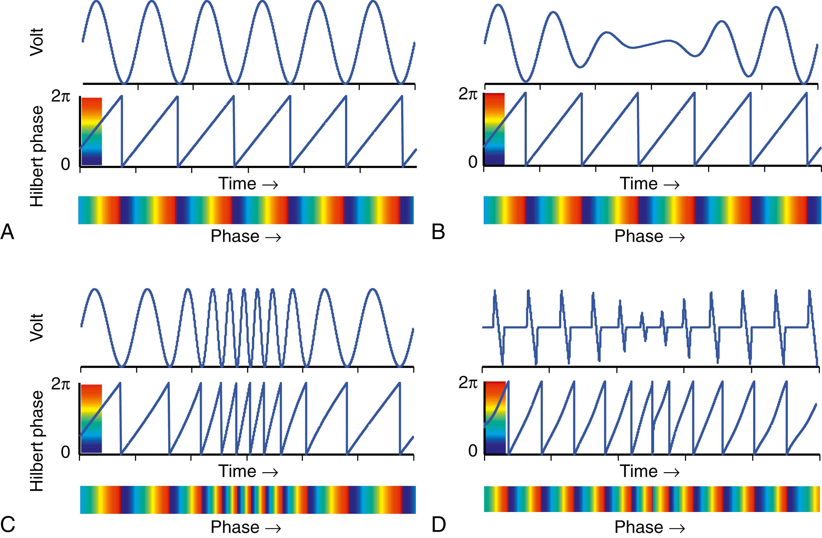 Fig. 35.2, Phase Representation of the Action Potential Using the Hilbert Transform.