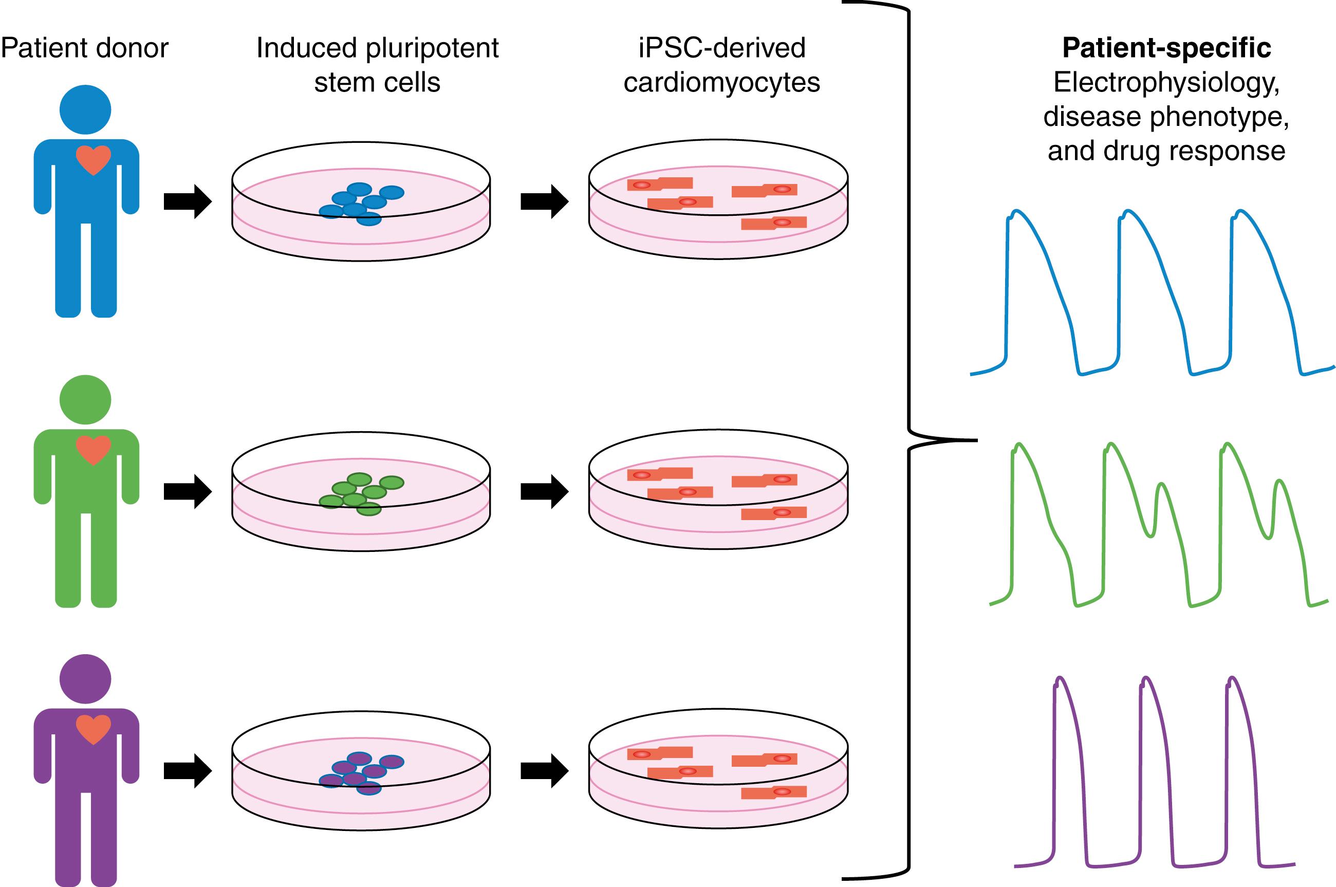 Fig. 9.1, Development of patient-specific embryonic-like pluripotent stem cell (iPSC)-derived cardiomyocytes resulting in patient-specific electrophysiology markers.