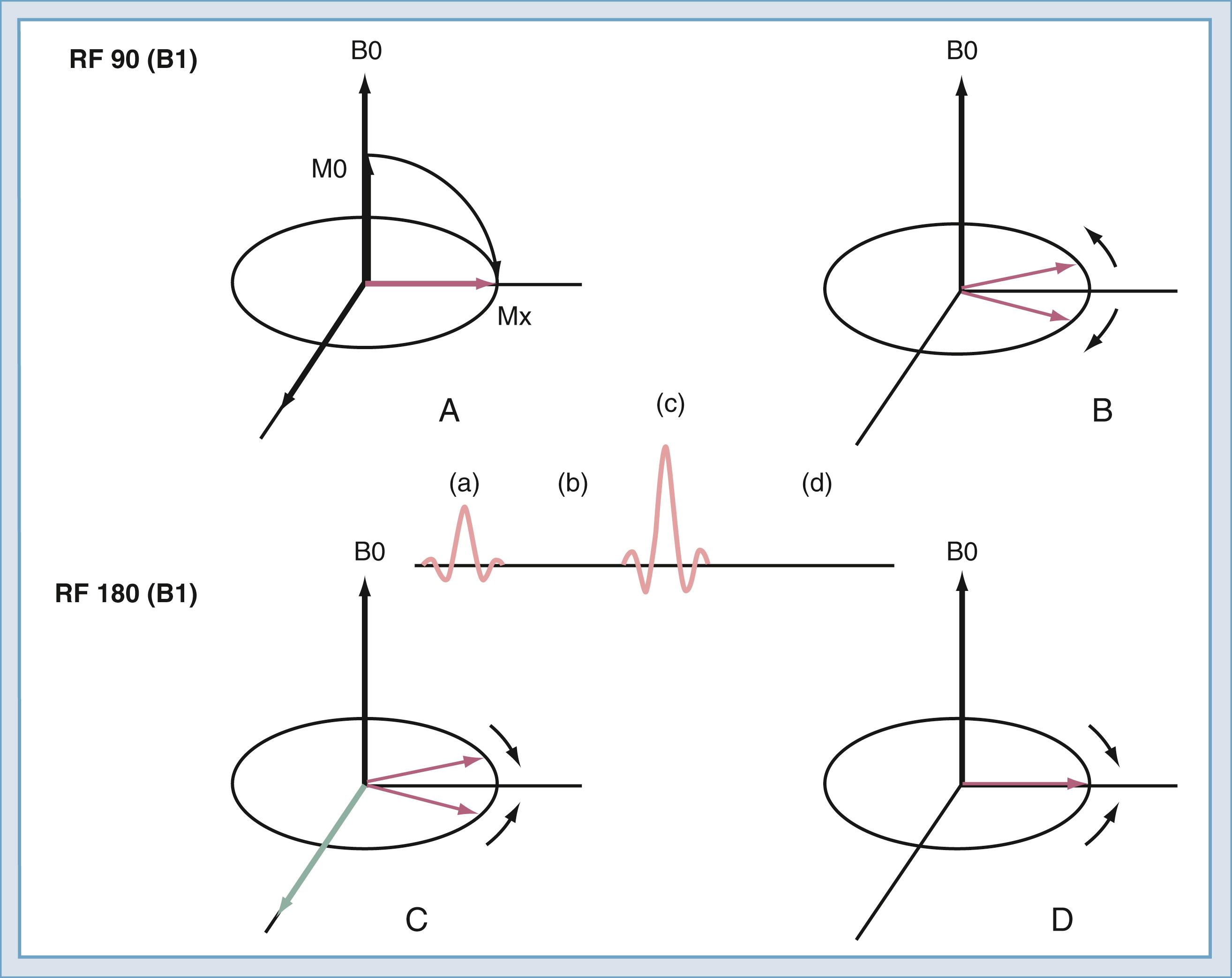 Figure 10.17, The spin echo starts with nutation of longitudinal magnetization into the transverse plane (Mx) (A). The magnetization decays over time (B) until the radiofrequency (RF) 180-degree pulse (C) reverses the direction of the spins, which then reform magnetization M0 at the echo time (D).