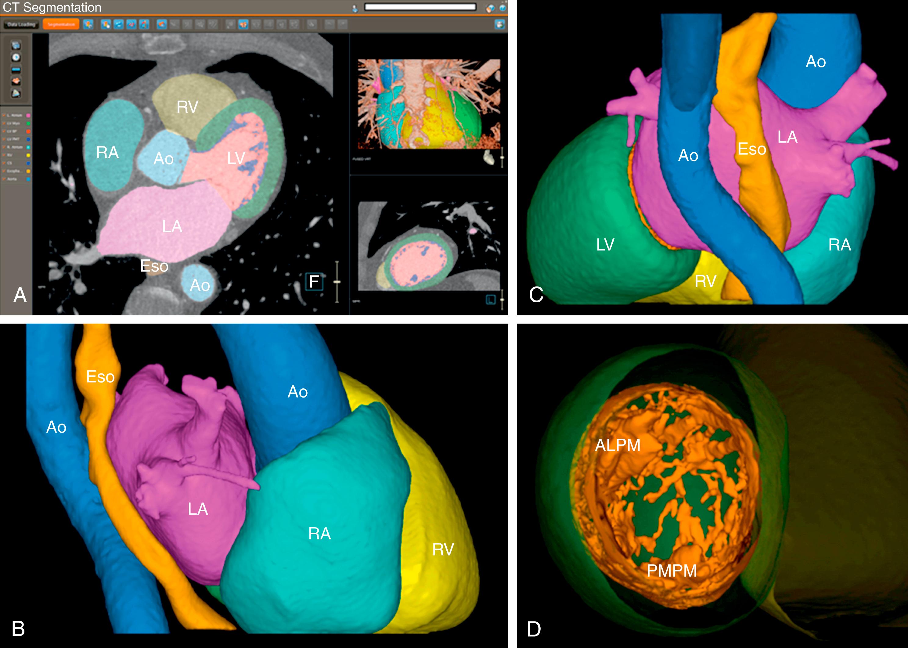 Fig. 64.1, CARTO segmentation module.