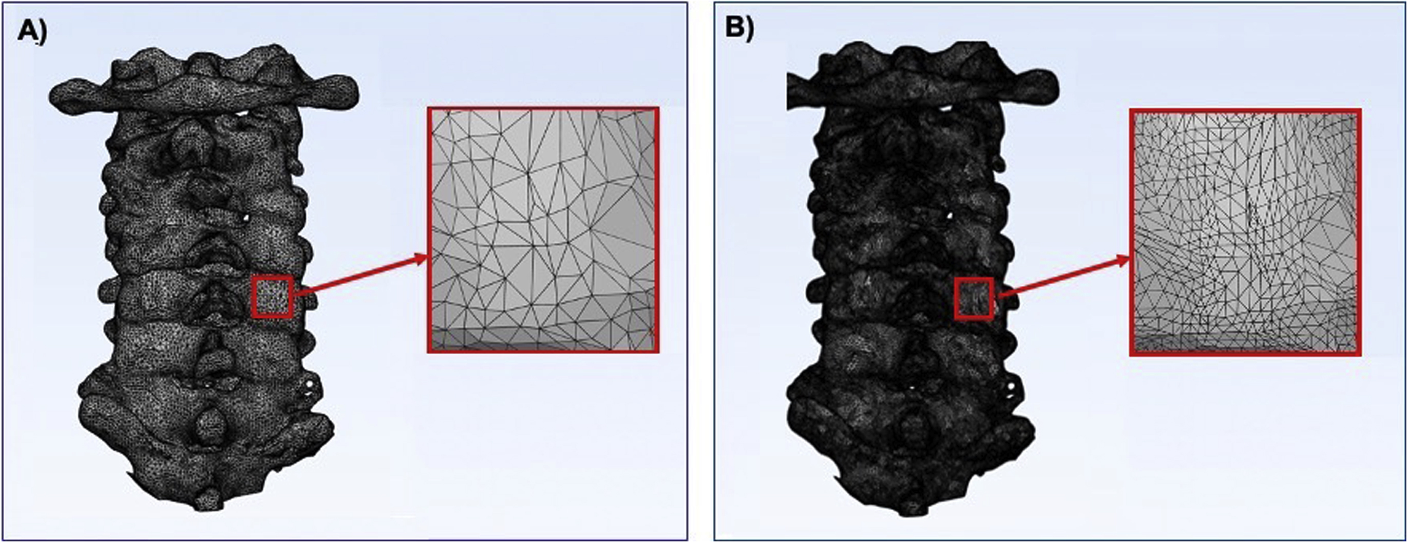 Fig. 4.1, Posterior cervical spine model with (A) 95,000 triangles and (B) 325,000 triangles.