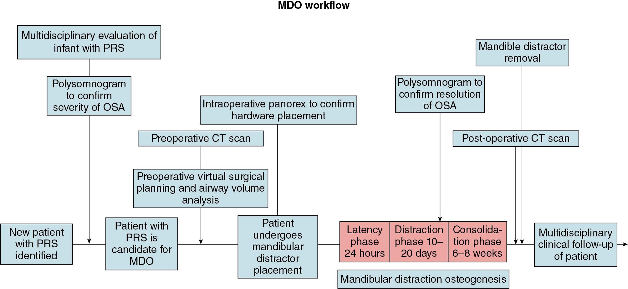 Fig. 16.1, Multidisciplinary workflow for mandibular distraction osteogenesis: preoperative evaluation, virtual surgical planning, surgical execution, distraction, and postoperative evaluation. MDO , Mandibular distraction osteogenesis; OSA , obstructive sleep apnea; PRS, Pierre Robin sequence.