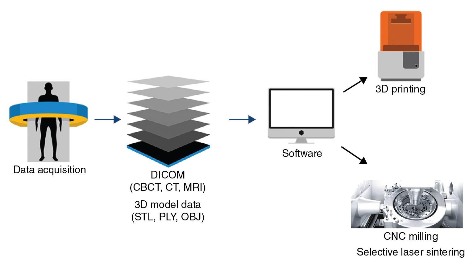 Fig. 27.1, Digital workflow in maxillofacial prosthetics.