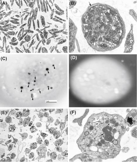 Figure 142.1, Examples of platelet and white blood cell electron microscopy.